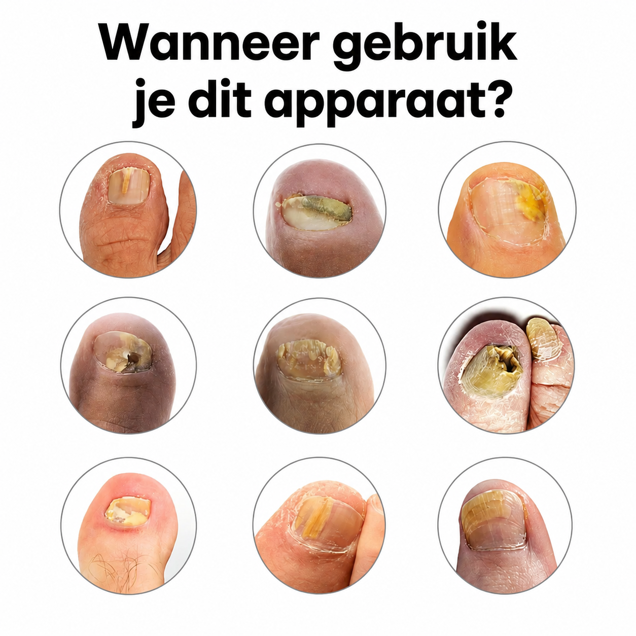 NagelHerstel Pro™