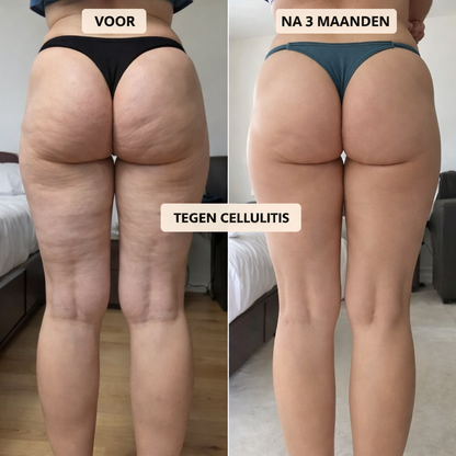 Lift-effect en Anti-Cellulite 3D Legging