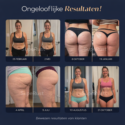 Lift-effect en Anti-Cellulite 3D Legging