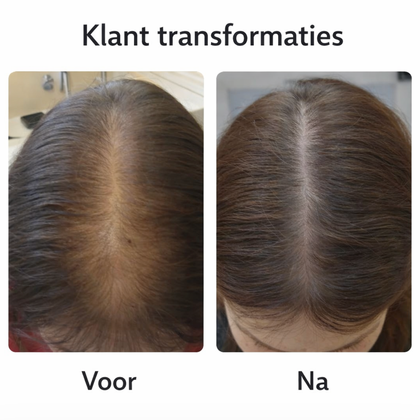 Extreme Thrive Elixer - Haargroei en Glans olie 60ml