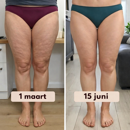 Lift-effect en Anti-Cellulite 3D Legging