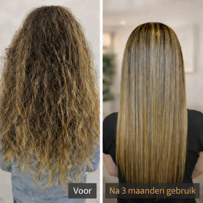 ScalpBoost™ – Hoofdhuid Massager