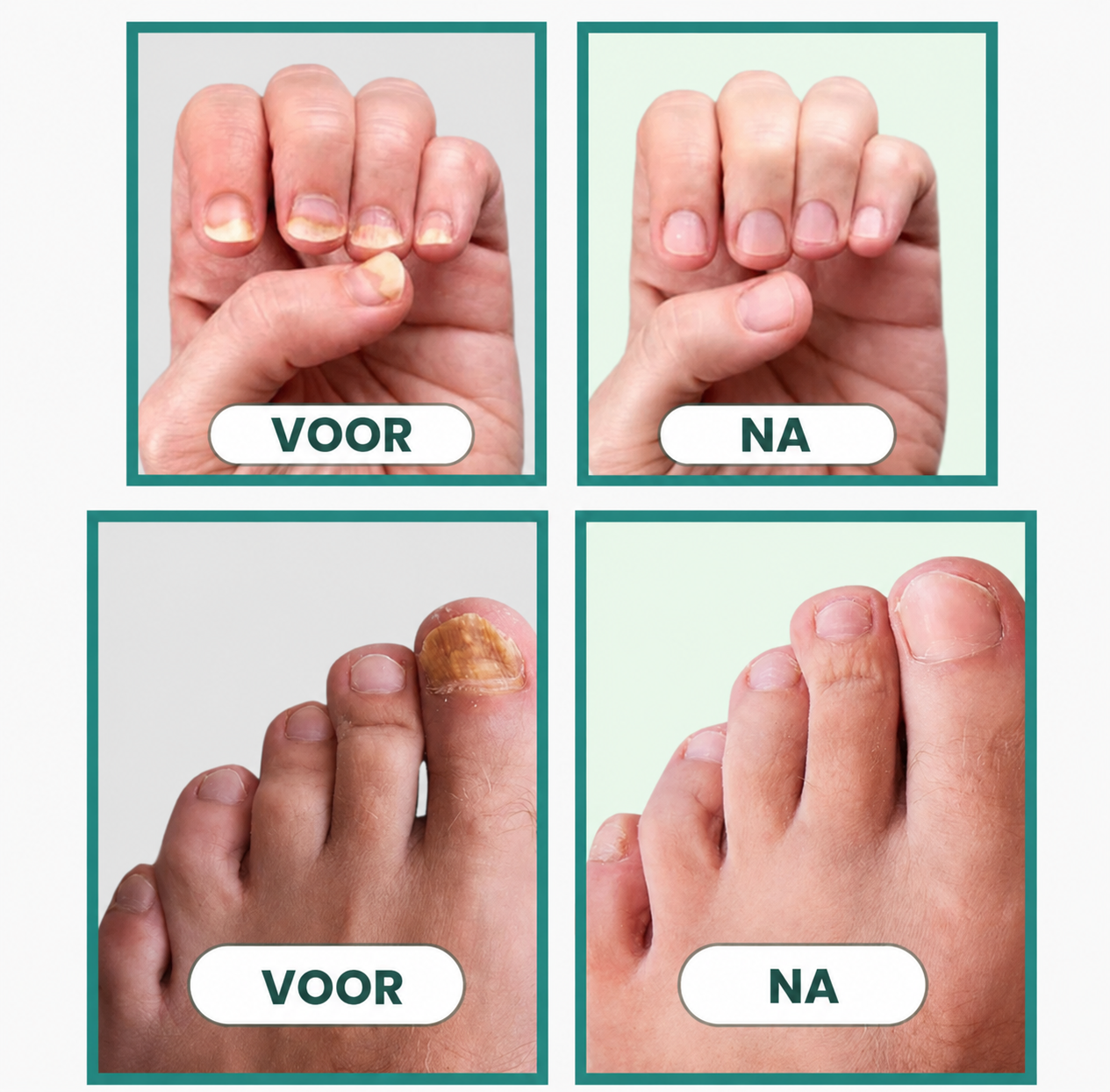NagelHerstel Pro™